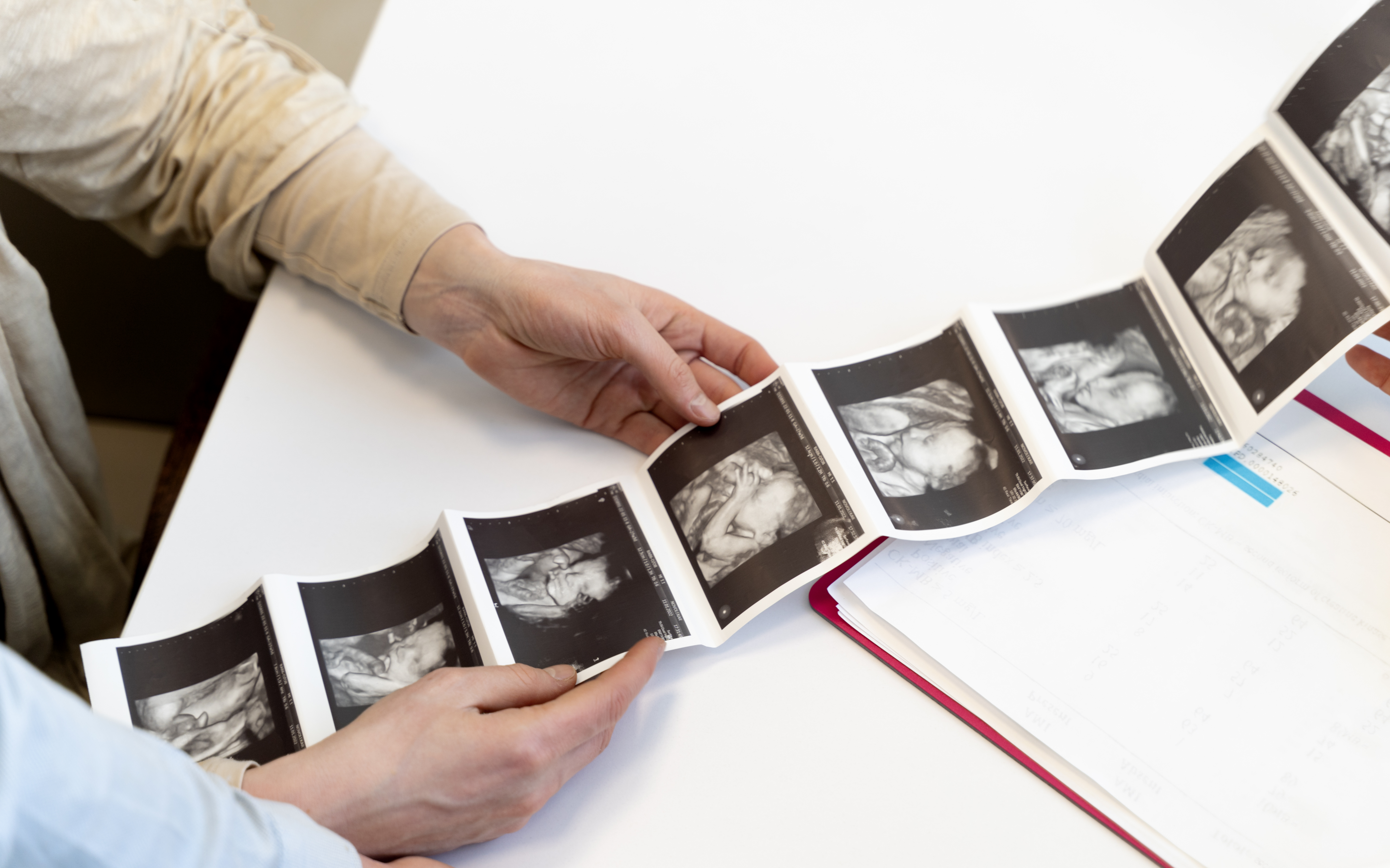 Simple mock layout of a pregnancy ultrasound report highlighting patient details, scan date, gestational age line, measurement table, and comments section